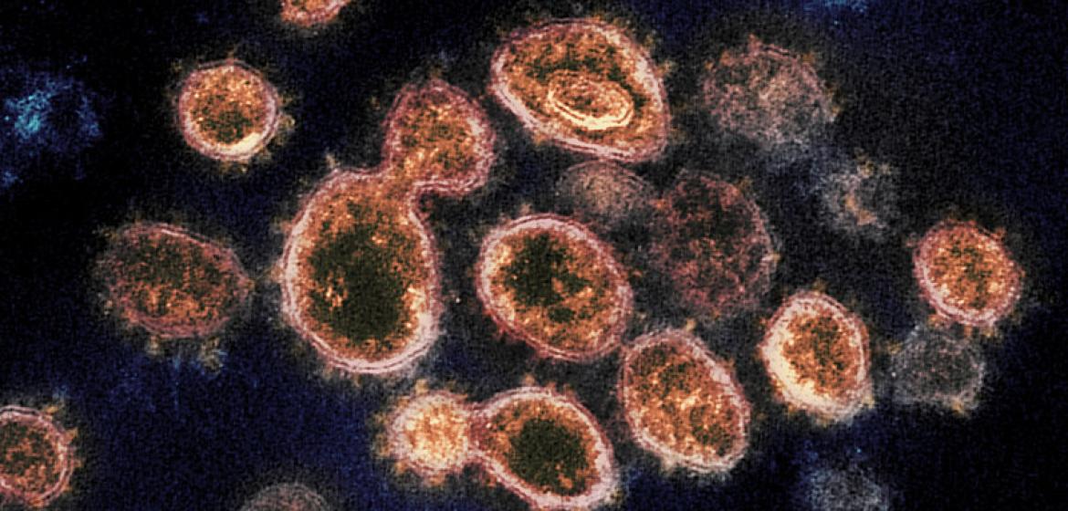 Das Corona-Virus bestimmt auch in WANA das Leben der Menschen. Bild: NIH Gallery, Creative Commons.  