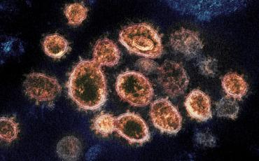 Das Corona-Virus bestimmt auch in WANA das Leben der Menschen. Bild: NIH Gallery, Creative Commons.  